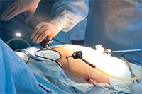 Endoscopy Treatment in Pune